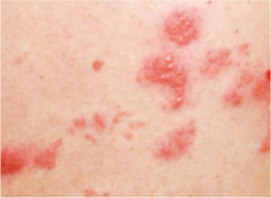 waterpokken-stadium-1