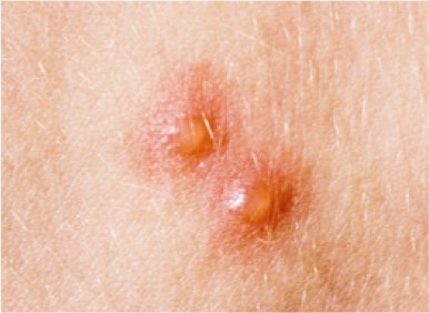 waterpokken-stadium-2