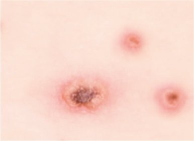 waterpokken-stadium-3